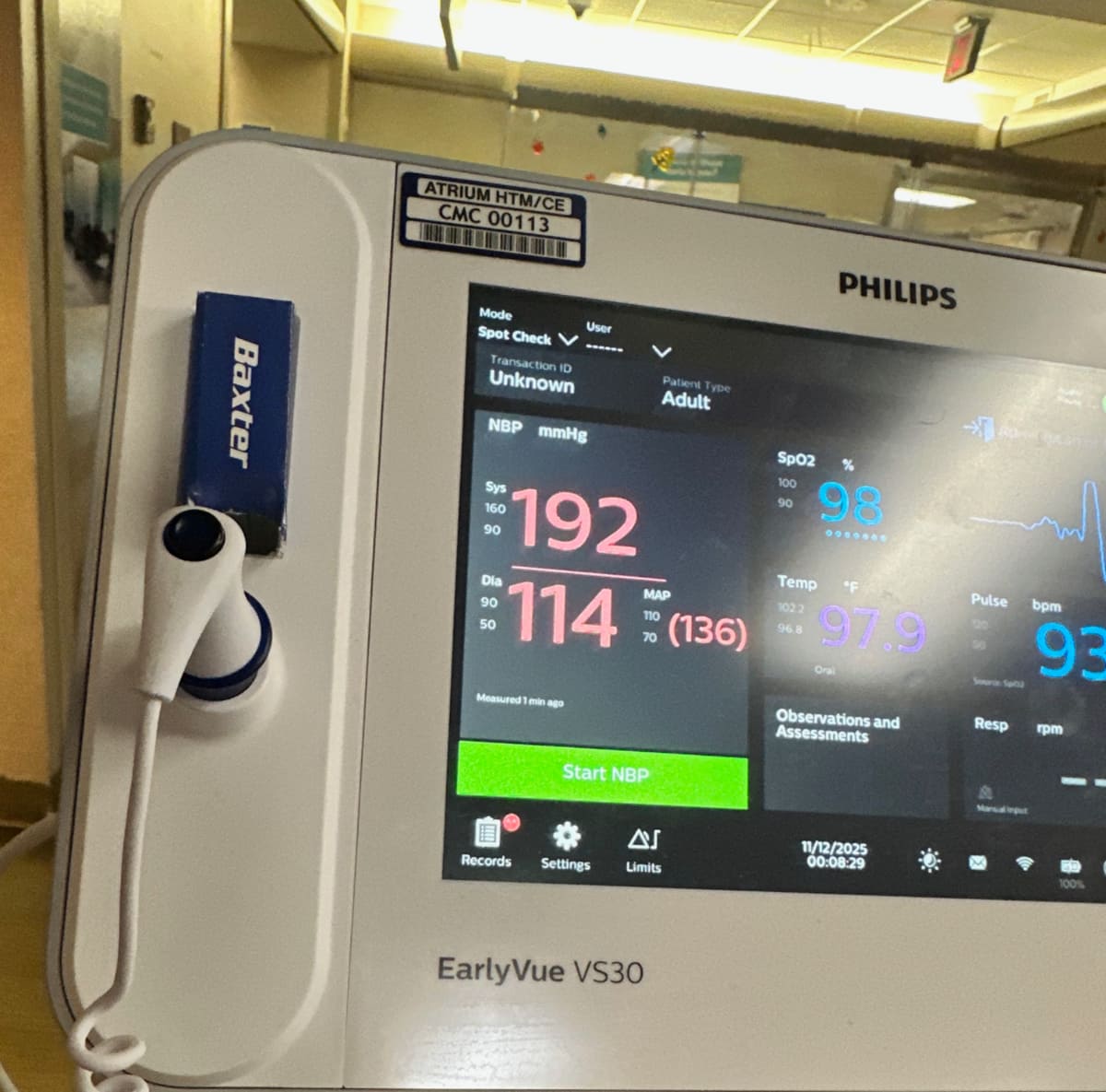 Hospital monitor systolic 192